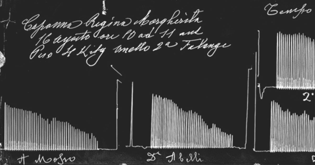 The Alps as a laboratory II: ANGELO MOSSO